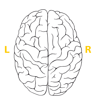 Brain Image